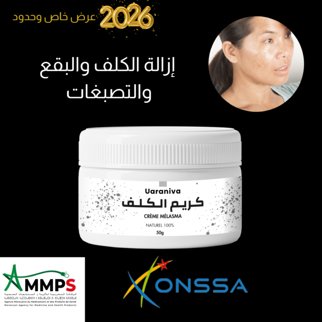 كريم الكلف والتصبغات